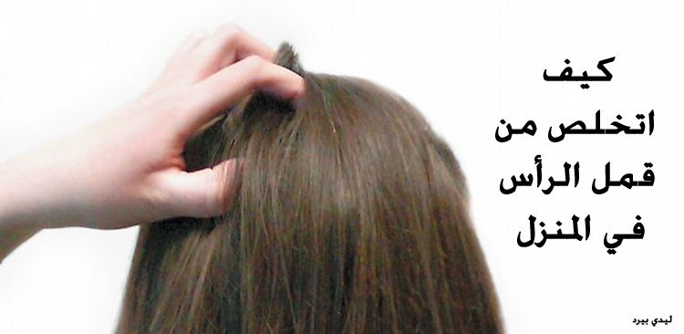 اتخلص من القمل في الرأس
