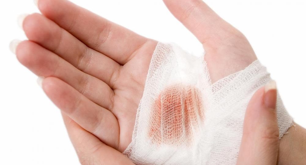 bandaged hand injury