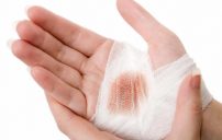bandaged hand injury
