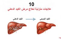fattyliver