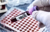 تحليل الكوليسترول الكامل: قراءة النتائج وفهم LDL وHDL بسهولة 6 4e4de5705c1590dce367f3c5067acbbc